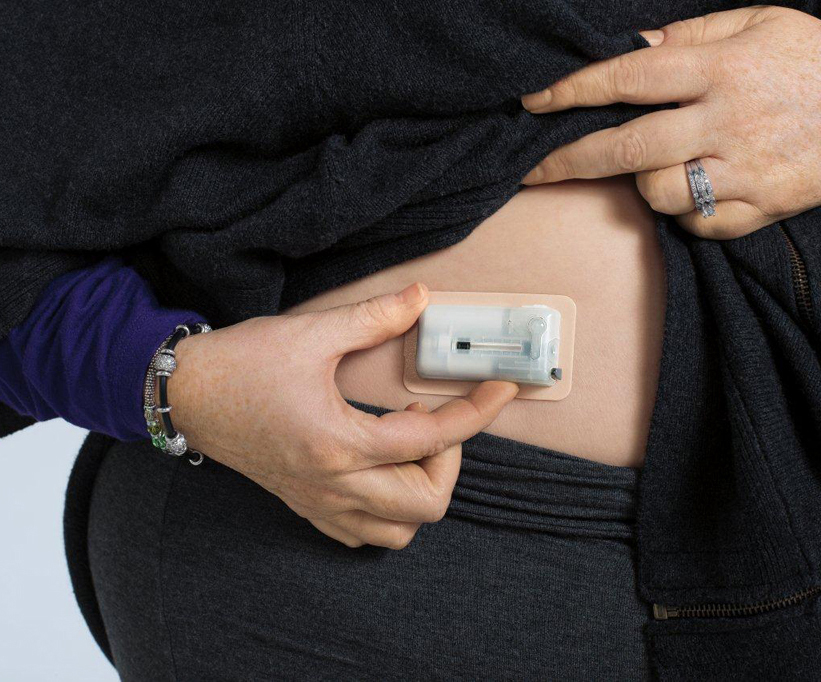 VGo SyringeLess Insulin Type 2 Nation