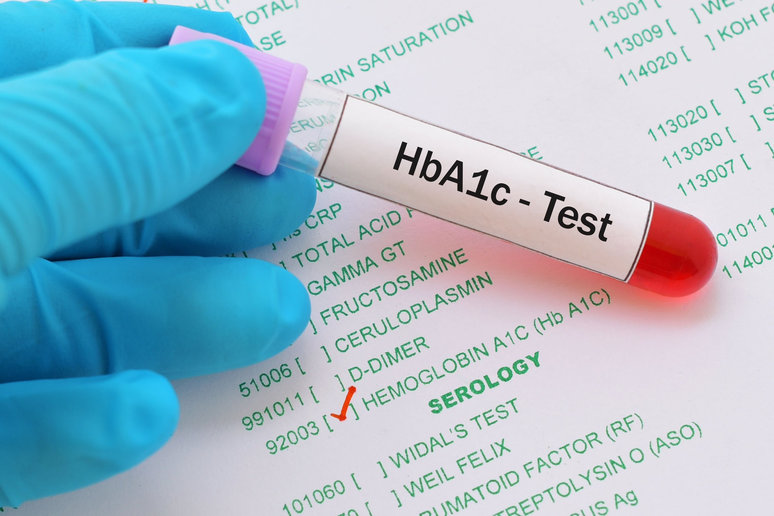 Малярия тесты с ответами для врачей. HBA 1 C. Hba1c гемоглобин. Тест на гликированный гемоглобин. Гликированный гемоглобин картинка.